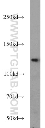 TRAPPC9 Antibody in Western Blot (WB)