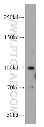 MMS19 Antibody in Western Blot (WB)