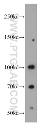 MMS19 Antibody in Western Blot (WB)