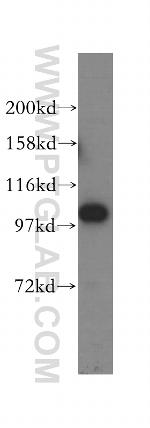 MMS19 Antibody in Western Blot (WB)