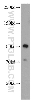 MMS19 Antibody in Western Blot (WB)