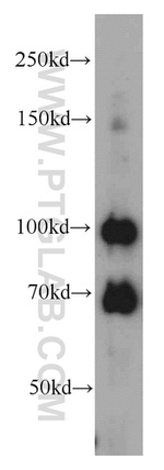 MMS19 Antibody in Western Blot (WB)