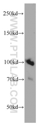 MMS19 Antibody in Western Blot (WB)