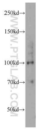 MMS19 Antibody in Western Blot (WB)