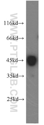 ILKAP Antibody in Western Blot (WB)