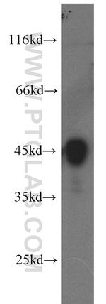 ILKAP Antibody in Western Blot (WB)