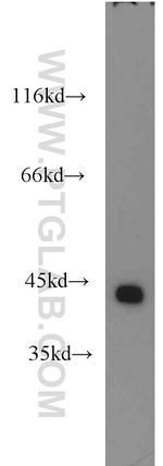 ILKAP Antibody in Western Blot (WB)