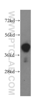 ILKAP Antibody in Western Blot (WB)