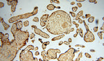 DBR1 Antibody in Immunohistochemistry (Paraffin) (IHC (P))