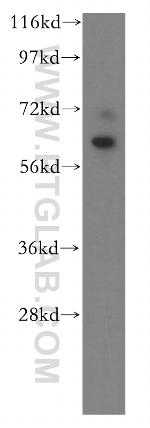 DBR1 Antibody in Western Blot (WB)