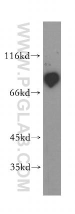 P3H3 Antibody in Western Blot (WB)