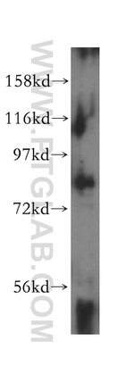 P3H3 Antibody in Western Blot (WB)