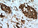 LETM1 Antibody in Immunohistochemistry (Paraffin) (IHC (P))