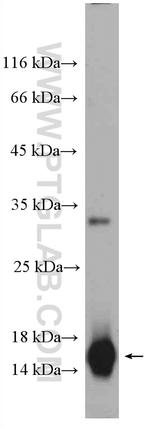 CST1 Antibody in Western Blot (WB)