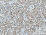 BCL2L2 Antibody in Immunohistochemistry (Paraffin) (IHC (P))