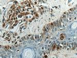 S100A1 Antibody in Immunohistochemistry (Paraffin) (IHC (P))