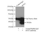 RNF2 Antibody in Immunoprecipitation (IP)