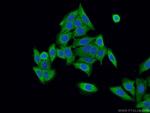 SRP19 Antibody in Immunocytochemistry (ICC/IF)