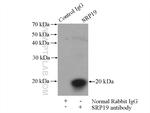 SRP19 Antibody in Immunoprecipitation (IP)