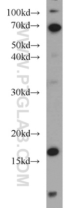 SRP19 Antibody in Western Blot (WB)