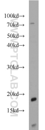 SRP19 Antibody in Western Blot (WB)