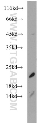 SRP19 Antibody in Western Blot (WB)