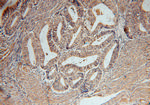 SERPINB2 Antibody in Immunohistochemistry (Paraffin) (IHC (P))