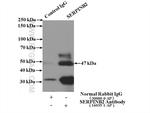 SERPINB2 Antibody in Immunoprecipitation (IP)