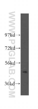 SERPINB2 Antibody in Western Blot (WB)