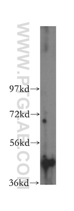 SERPINB2 Antibody in Western Blot (WB)