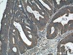 Amphiregulin Antibody in Immunohistochemistry (Paraffin) (IHC (P))