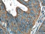 Amphiregulin Antibody in Immunohistochemistry (Paraffin) (IHC (P))