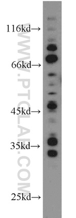 Amphiregulin Antibody in Western Blot (WB)