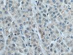 NDUFB6 Antibody in Immunohistochemistry (Paraffin) (IHC (P))