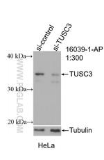 TUSC3 Antibody in Western Blot (WB)