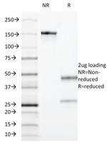 CD55/Decay Accelerating Factor (DAF) Antibody in SDS-PAGE (SDS-PAGE)