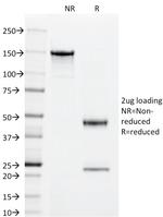 CD55/Decay Accelerating Factor (DAF) Antibody in SDS-PAGE (SDS-PAGE)