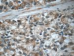 C20orf195 Antibody in Immunohistochemistry (Paraffin) (IHC (P))