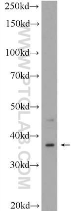 C20orf195 Antibody in Western Blot (WB)