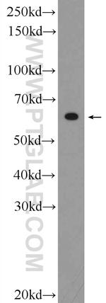 C20orf195 Antibody in Western Blot (WB)