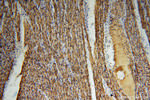 Myoglobin Antibody in Immunohistochemistry (Paraffin) (IHC (P))