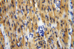 Myoglobin Antibody in Immunohistochemistry (Paraffin) (IHC (P))