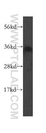 SULT1B1 Antibody in Western Blot (WB)