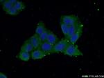 LYPLA1 Antibody in Immunocytochemistry (ICC/IF)