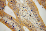 LYPLA1 Antibody in Immunohistochemistry (Paraffin) (IHC (P))