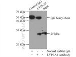 LYPLA1 Antibody in Immunoprecipitation (IP)