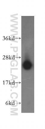 LYPLA1 Antibody in Western Blot (WB)