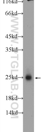 LYPLA1 Antibody in Western Blot (WB)