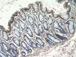 TSPAN1 Antibody in Immunohistochemistry (Paraffin) (IHC (P))