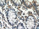 TSPAN1 Antibody in Immunohistochemistry (Paraffin) (IHC (P))